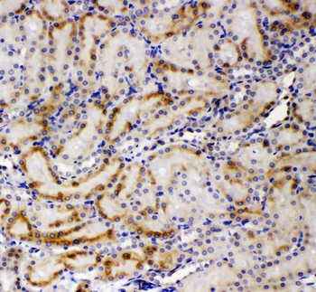 Anti-AMFR Antibody