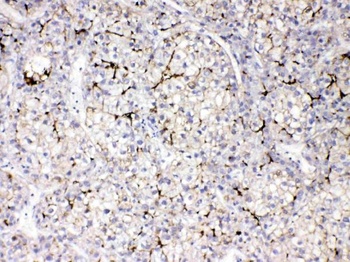 Anti-Apolipoprotein B/APOB Antibody