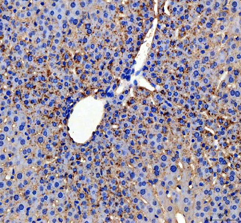 Anti-Apolipoprotein CIII/APOC3 Antibody
