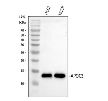Anti-Apolipoprotein CIII/APOC3 Antibody