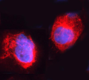 Anti-ARHGEF1 Antibody