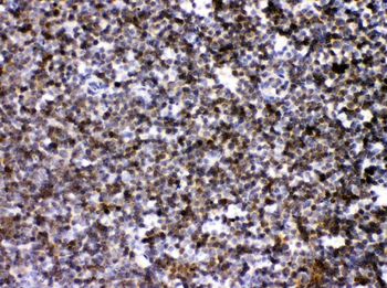 Anti-ARHGEF1 Antibody