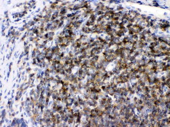 Anti-ARHGEF1 Antibody