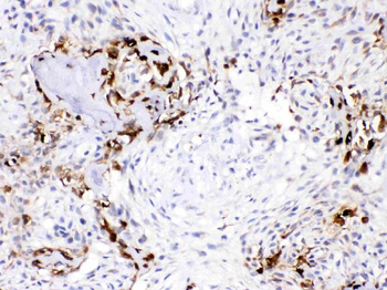 Carbonic Anhydrase III/CA3 Antibody