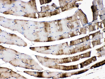 Anti-Carbonic Anhydrase III/CA3 Antibody