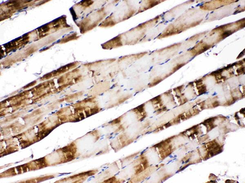 Anti-Carbonic Anhydrase III/CA3 Antibody