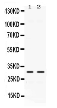 Anti-Carbonic Anhydrase III/CA3 Antibody