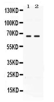 CCDC6 Antibody