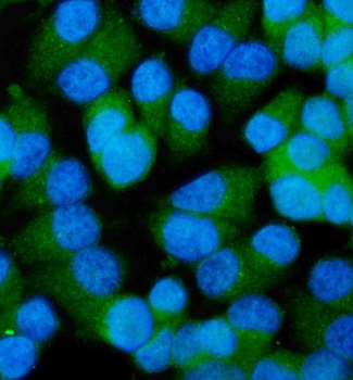 Anti-CCDC6 Antibody
