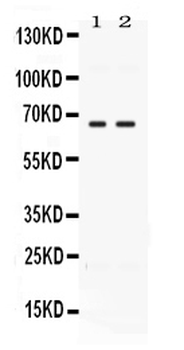Anti-CCDC6 Antibody