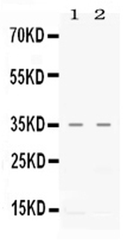 Anti-CXCL16 Antibody