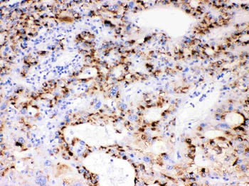 Cytochrome P450 3A4/CYP3A4 Rabbit Polyclonal Antibody
