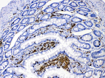 Anti-DHODH Antibody
