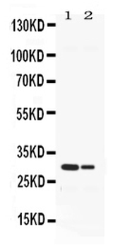 Anti-Neutrophil Elastase/ELANE Antibody