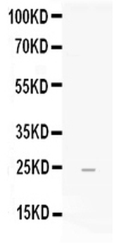 Anti-FGF19 Antibody