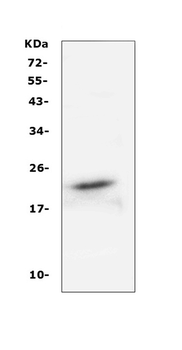 Anti-FGF21 Antibody