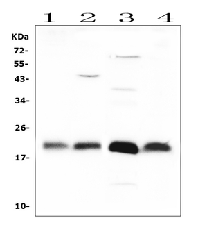 Anti-FGF21 Antibody