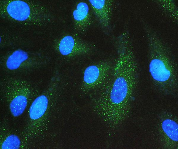 Anti-GNB1 Antibody