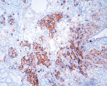Anti-GNB1 Antibody