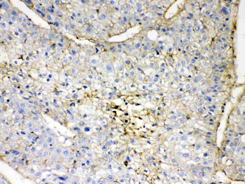Anti-GNB1 Antibody