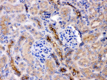 Anti-GNB1 Antibody