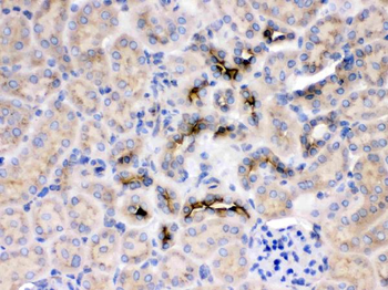 Anti-GNB1 Antibody