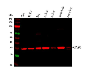 Anti-GNB1 Antibody