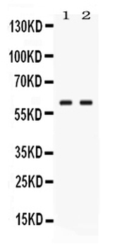 Glucose 6 phosphate isomerase/GPI Rabbit Polyclonal Antibody