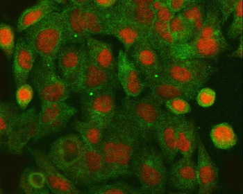 Anti-HLTF Antibody