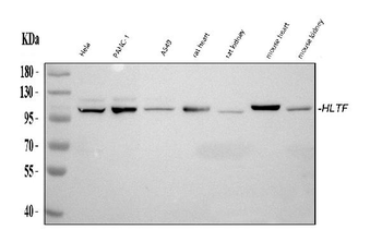Anti-HLTF Antibody