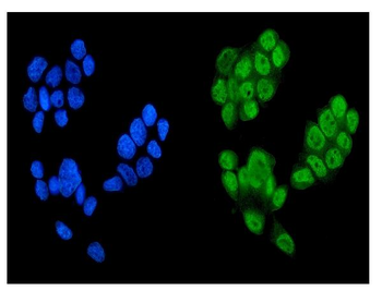 Anti-KDM5B/PLU1/Jarid1B Antibody