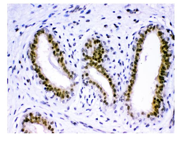 Anti-KDM5B/PLU1/Jarid1B Antibody
