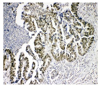 Anti-KDM5B/PLU1/Jarid1B Antibody