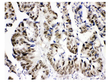 Anti-KDM5B/PLU1/Jarid1B Antibody
