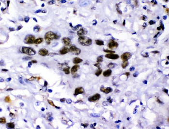 Anti-KDM5B/PLU1/Jarid1B Antibody