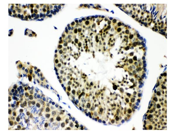 Anti-KDM5B/PLU1/Jarid1B Antibody