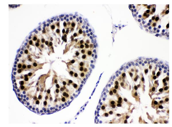 Anti-KDM5B/PLU1/Jarid1B Antibody