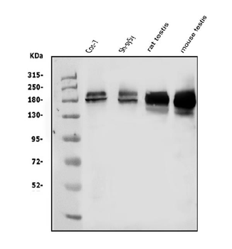 Anti-KDM5B/PLU1/Jarid1B Antibody