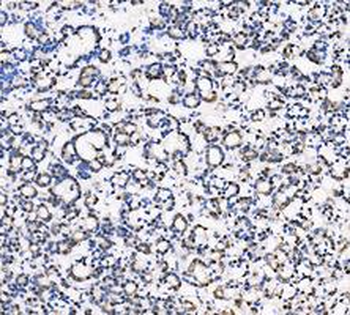 Anti-LDHA Antibody