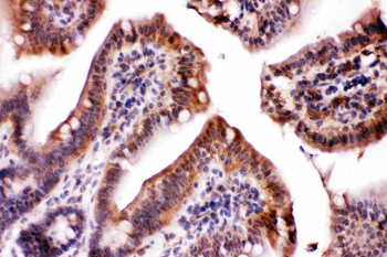 Anti-LDHA Antibody