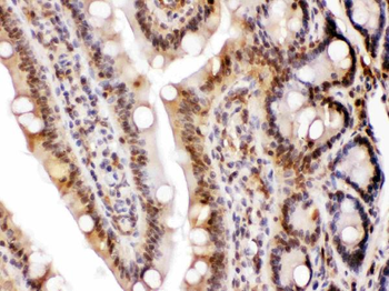 Anti-LDHA Antibody