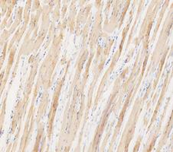 Anti-LDHA Antibody