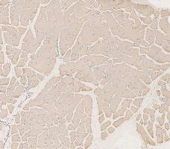 Anti-LDHA Antibody