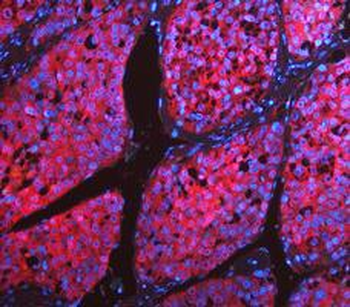 Anti-LDHA Antibody