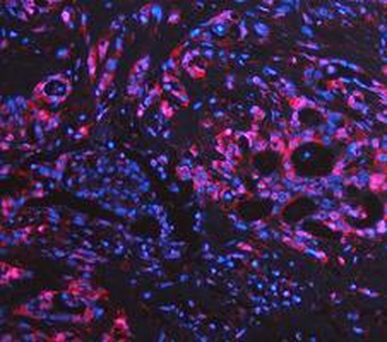 Anti-LDHA Antibody