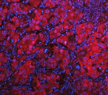 Anti-LDHA Antibody