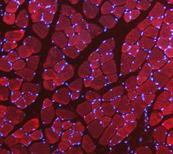 Anti-LDHA Antibody