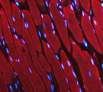 Anti-LDHA Antibody
