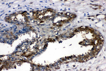 Anti-LDHA Antibody