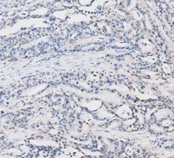 Anti-LDHA Antibody